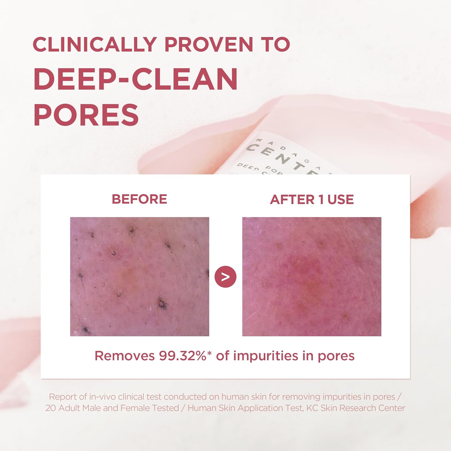 SKIN1004 Poremizing Deep Cleansing Foam, 4.23 fl.oz, 125ml, Makeup Remover, Korean Face Cleanser with Himalayan Pink Salt & Madagascar Centella Asiatica for Facial Pore Cleansing, Korean Skin Care